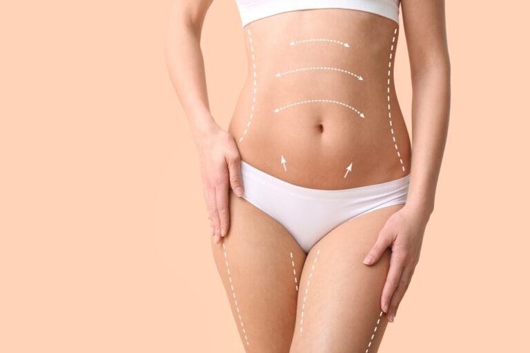 female body liposuction