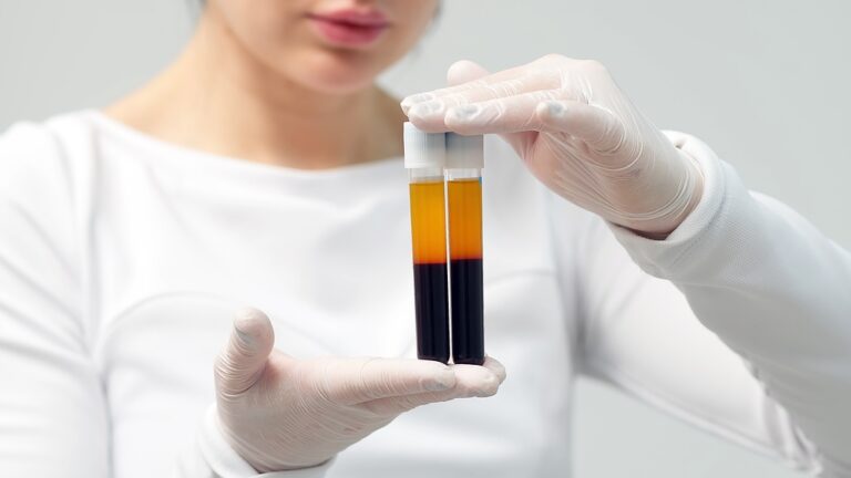 platelet rich plasma