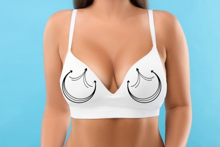 breast lift mastopexy