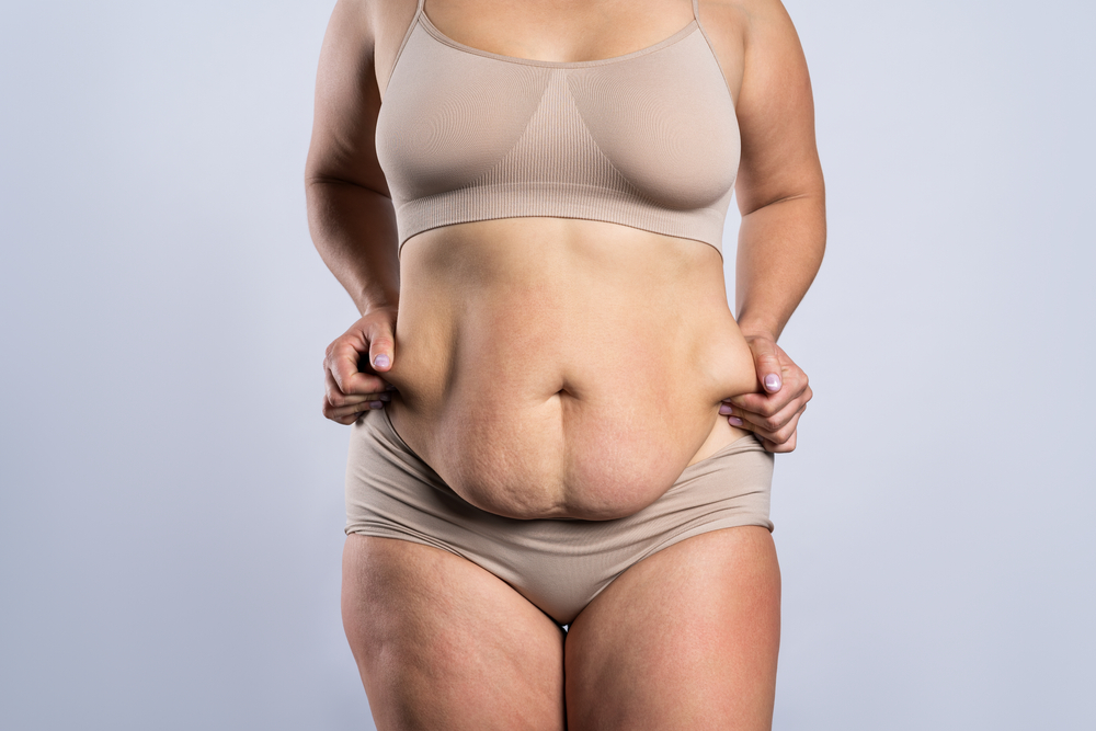 Before and after results of Full Body Lift Surgery
