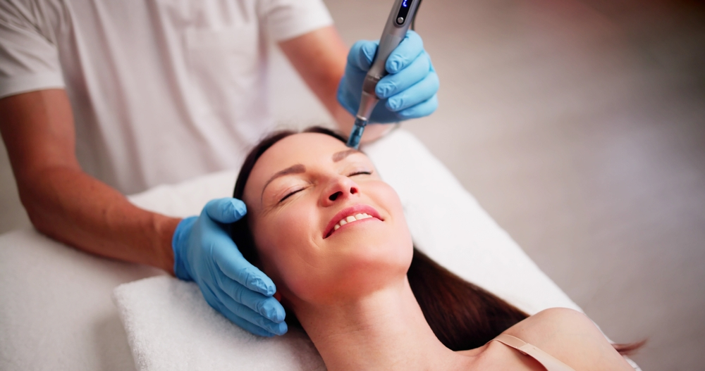 microneedling