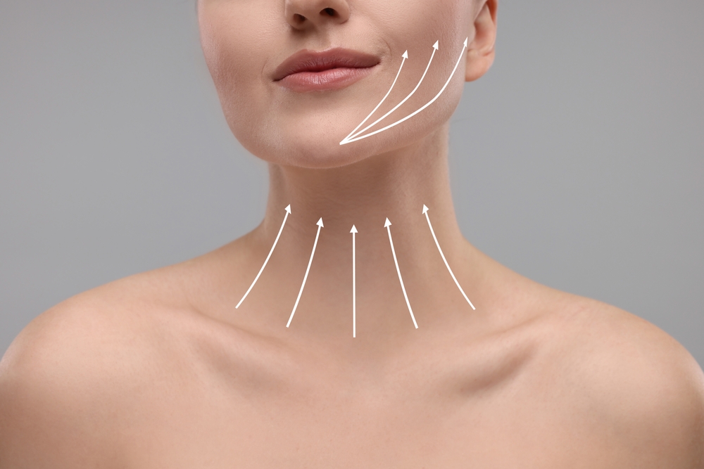 neck lift surgery