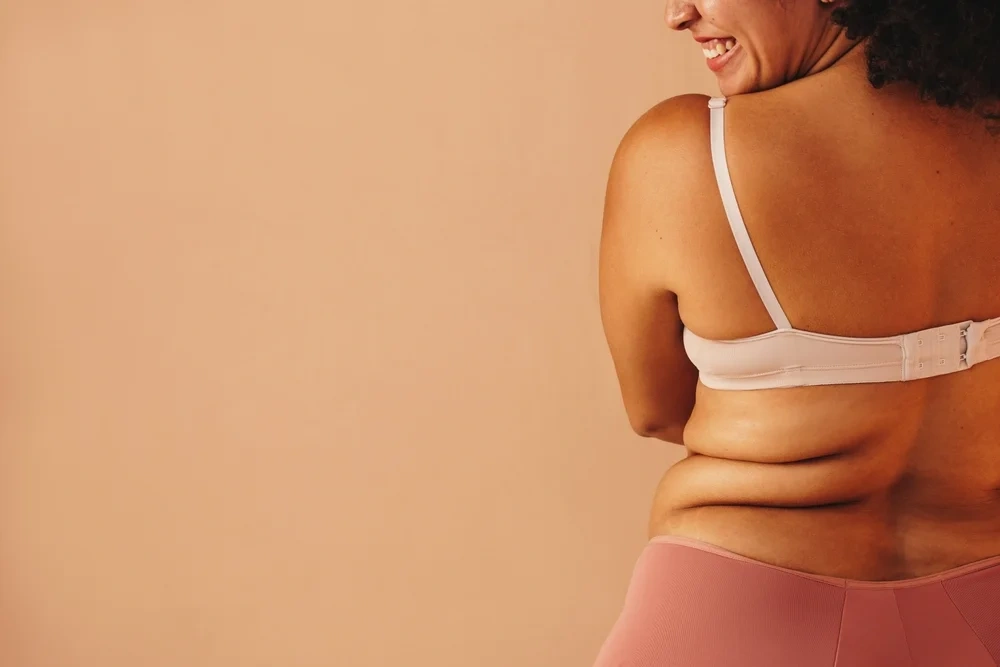 removal of excess fat from the lower back area.