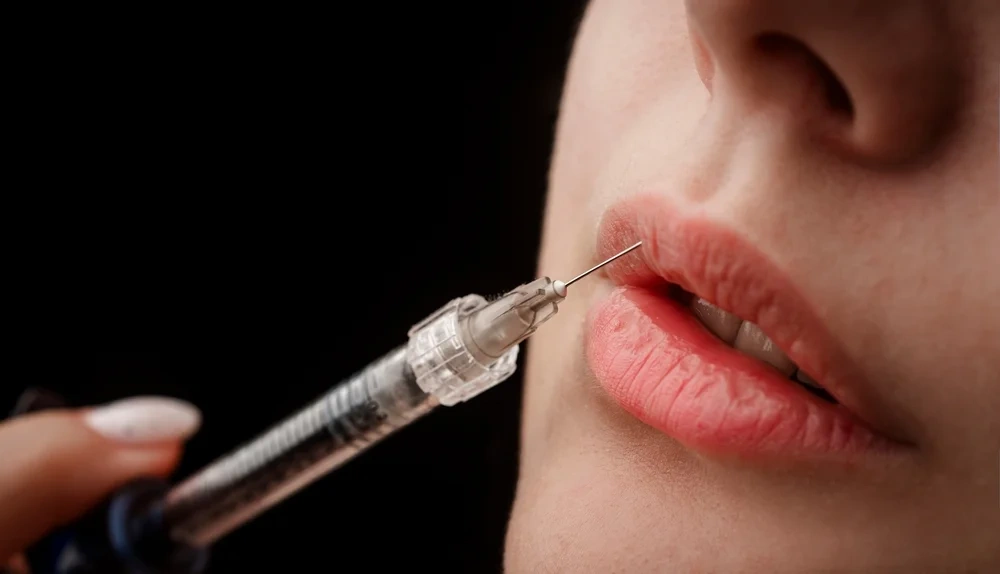 Dermal filler injections for Anti-Aging Treatments in Ahmedabad.