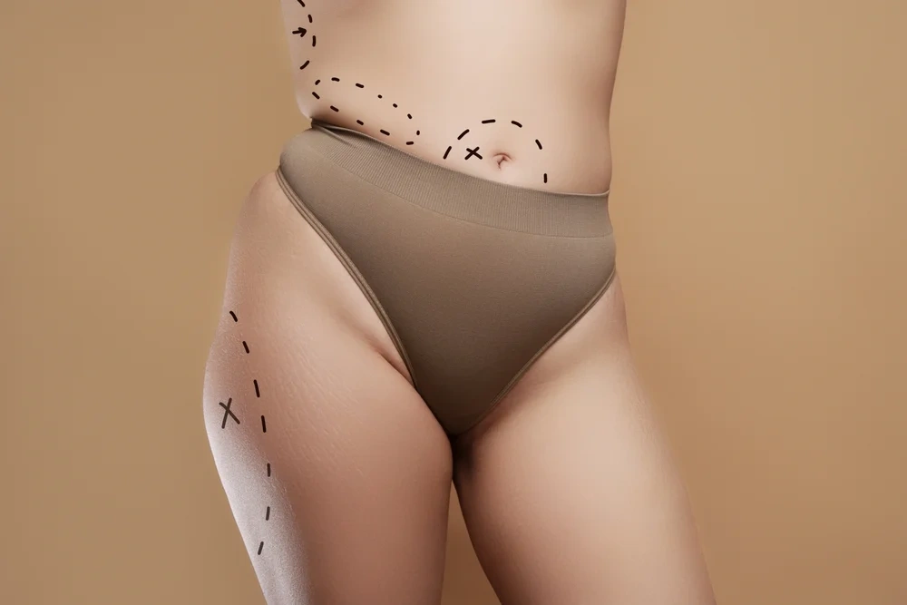 Fit woman posing with toned outer thighs and smooth hip curves.