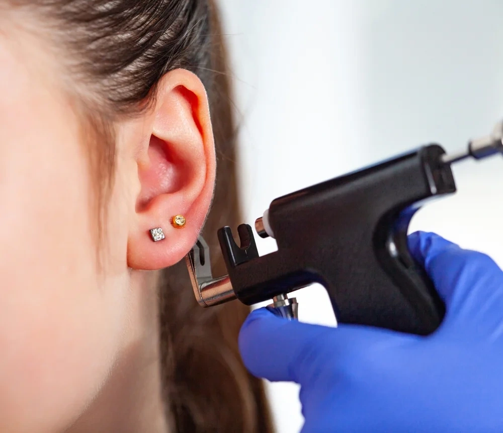 Full Facelift surgery as part of Face Treatments in Ahmedabad.