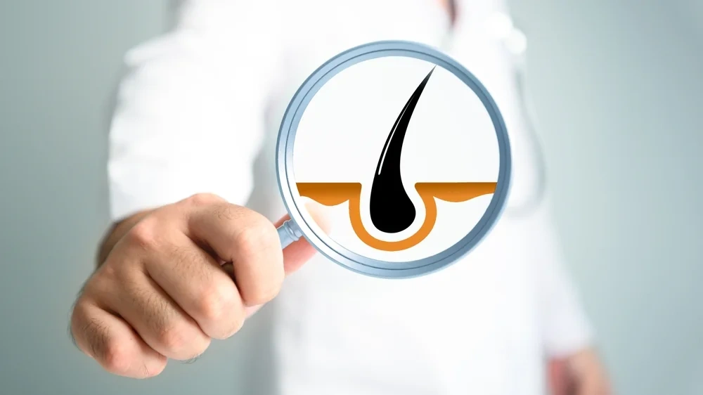 Doctor examining hair follicles under a magnifying glass.