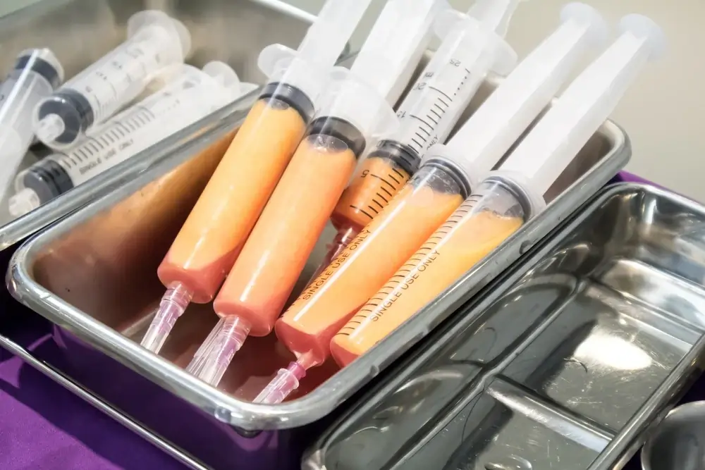 Fat grafting technique for Breast Enhancement in Ahmedabad.