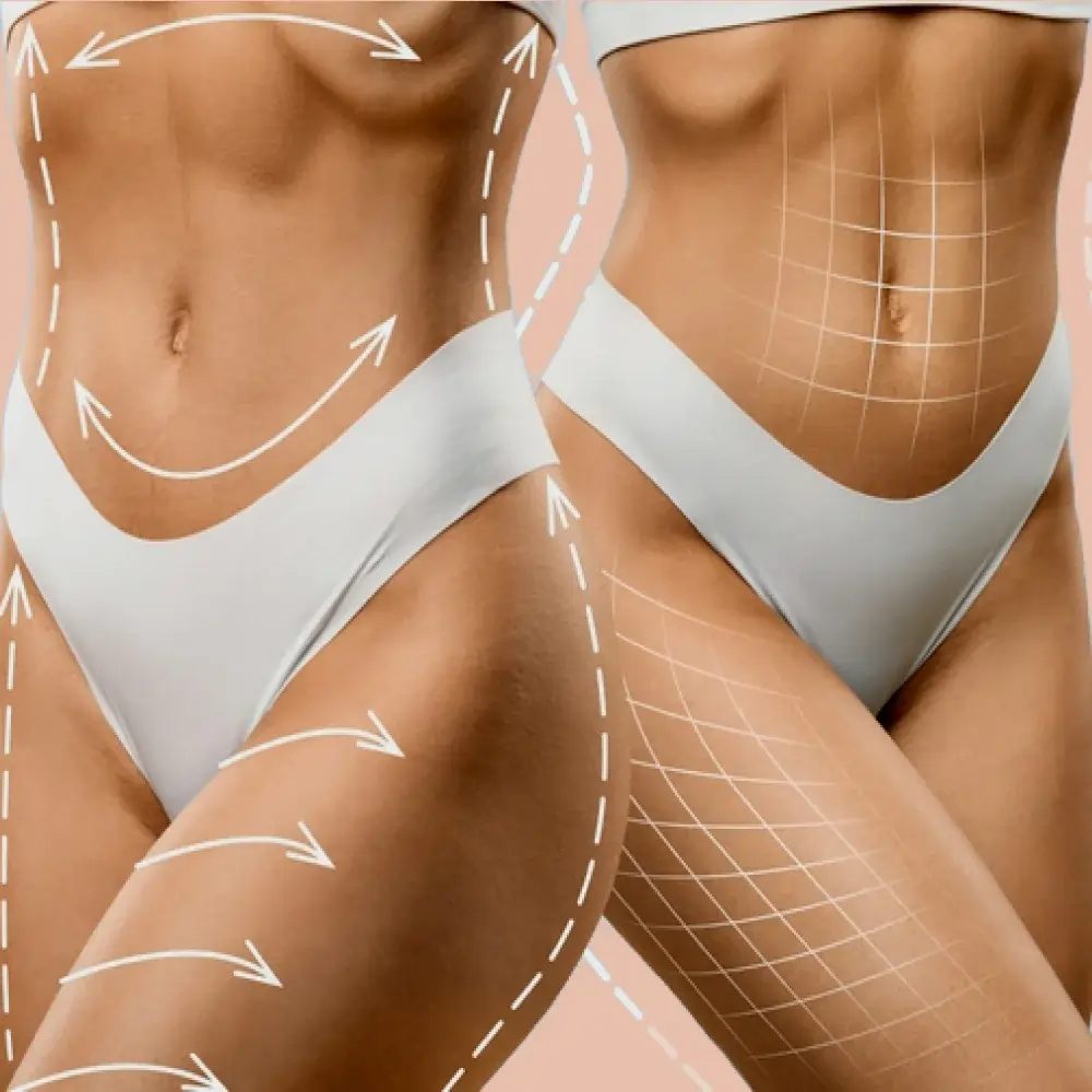 Center for Best Aesthetic and Cosmetic Surgery in Ahmedabad by Morph.