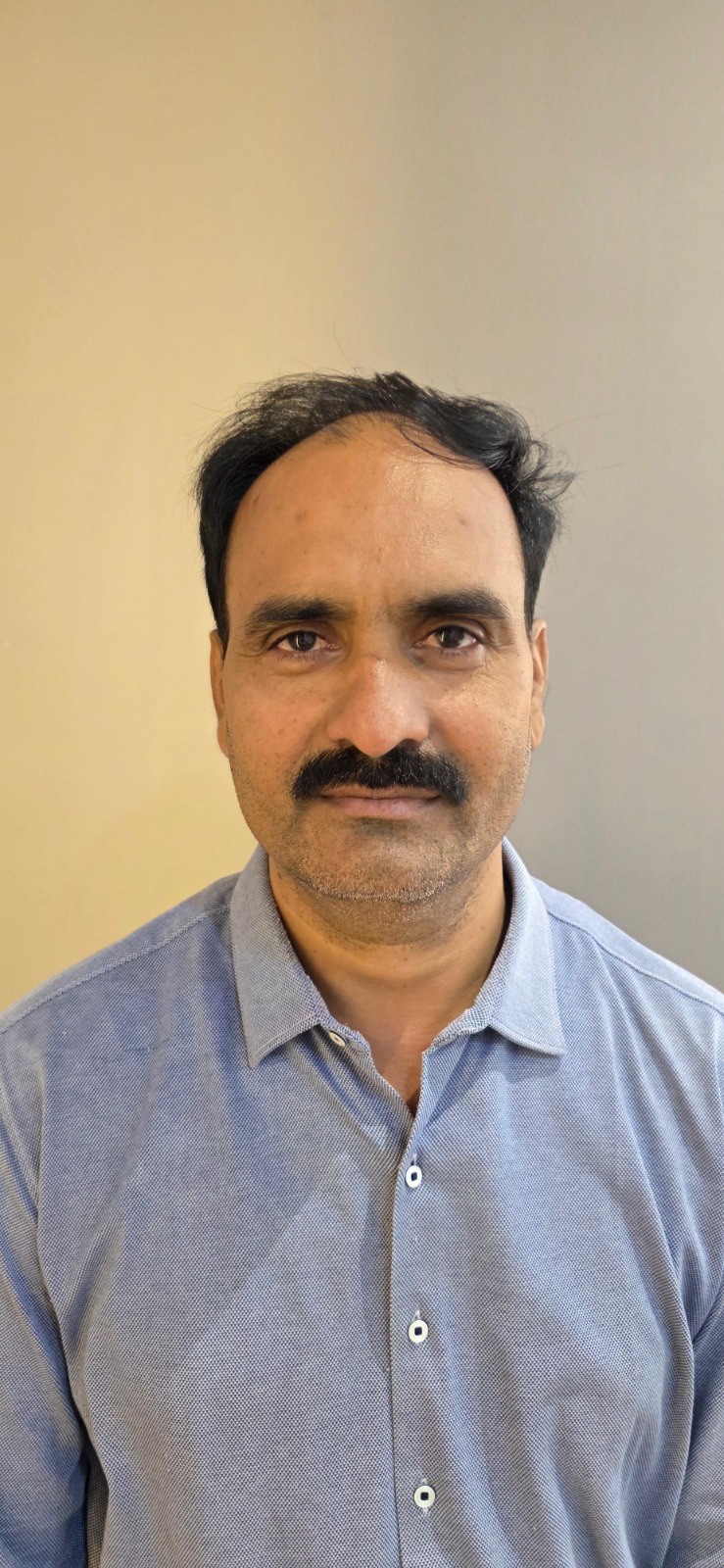 Before hair transplant — full restoration