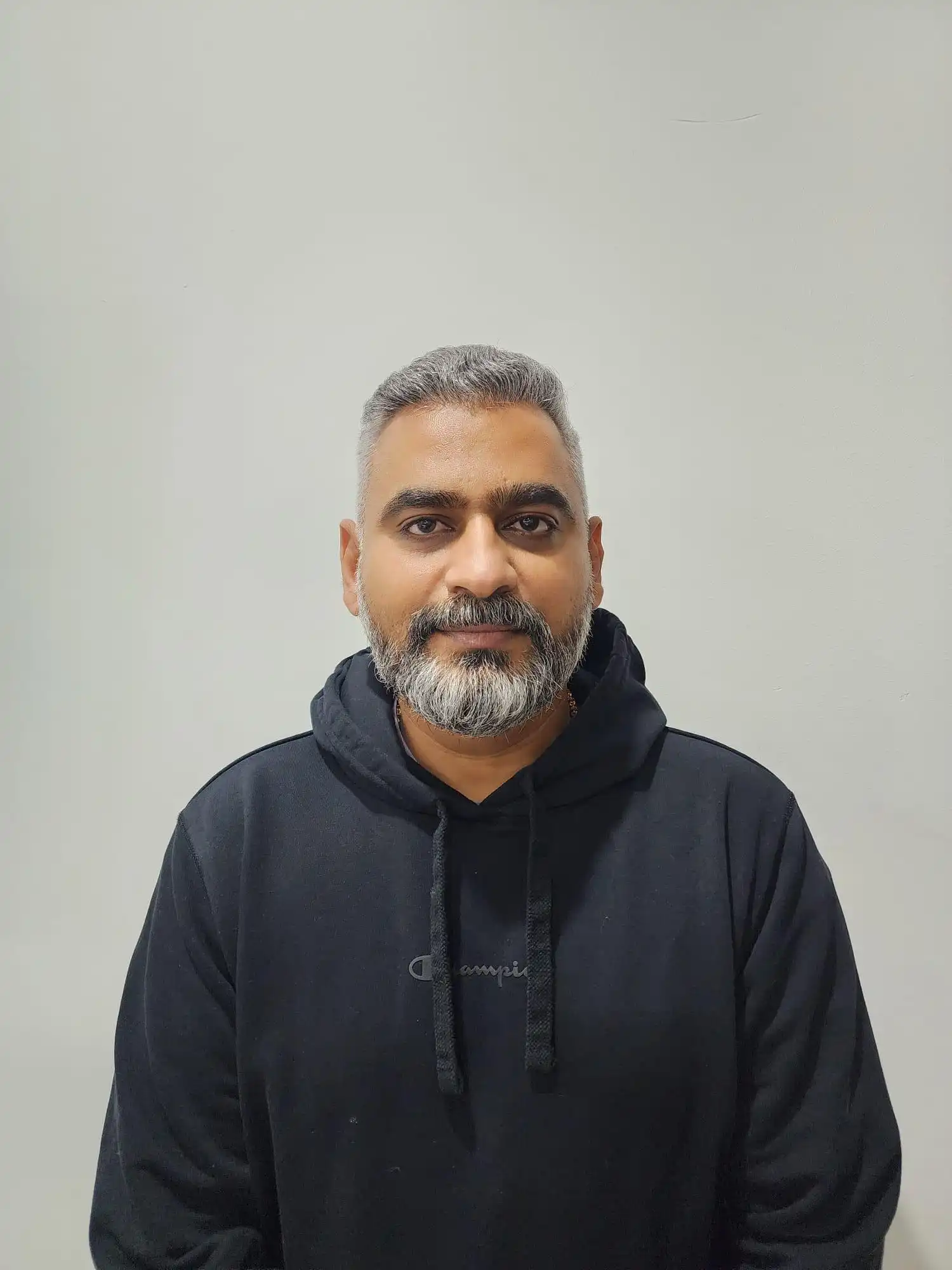 After hair transplant — full restoration